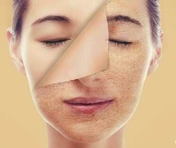 Bạn Đã Biết Dùng Retinol Đúng Cách Để Ngăn Chặn Lão Hóa Trên Da?