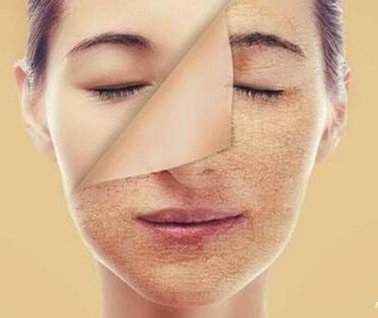 Bạn Đã Biết Dùng Retinol Đúng Cách Để Ngăn Chặn Lão Hóa Trên Da?