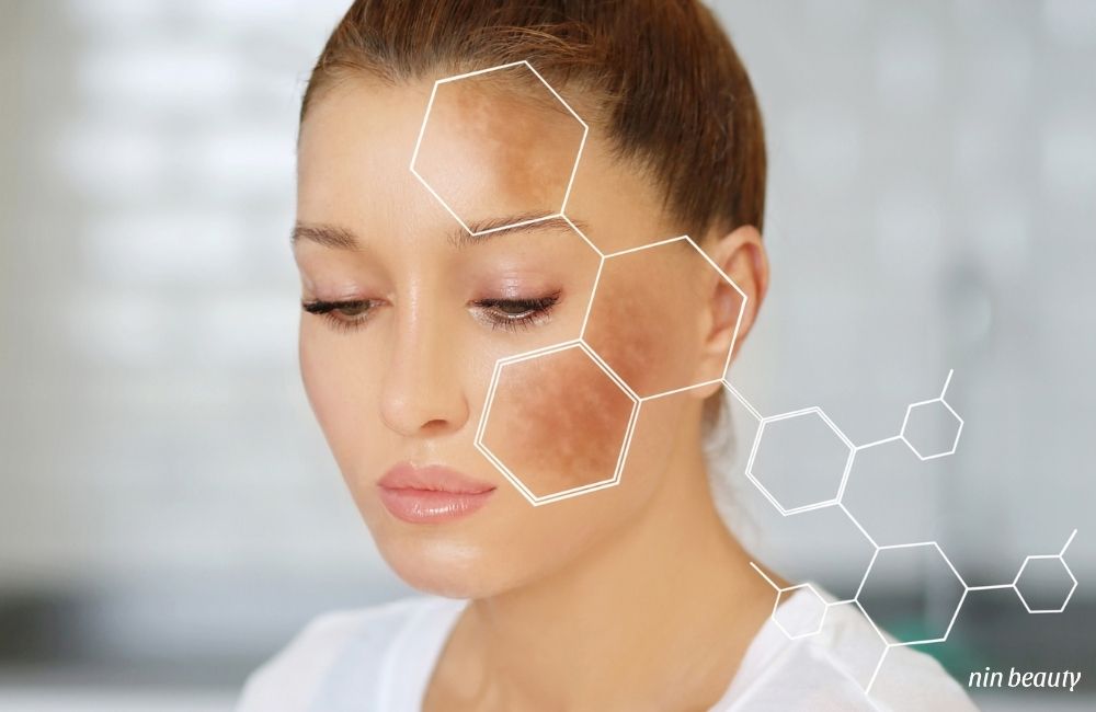 Nền Da Yếu Thủ Phạm Chính Gây Nám Da Bạn Đã Biết?