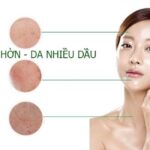 Tại Sao Da Lại Tiết Quá Nhiều Dầu? Lý Do Nằm Ở Đâu? 7 Tại Sao Da Lại Tiết Quá Nhiều Dầu? Lý Do Nằm Ở Đâu?