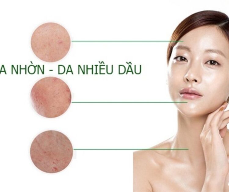 Tại Sao Da Lại Tiết Quá Nhiều Dầu? Lý Do Nằm Ở Đâu?