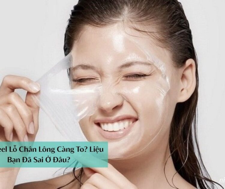 Càng Peel Lỗ Chân Lông Càng To? Liệu Bạn Đã Sai Ở Đâu?