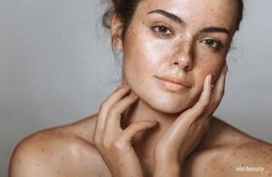 Nền Da Yếu Thủ Phạm Chính Gây Nám Da Bạn Đã Biết?