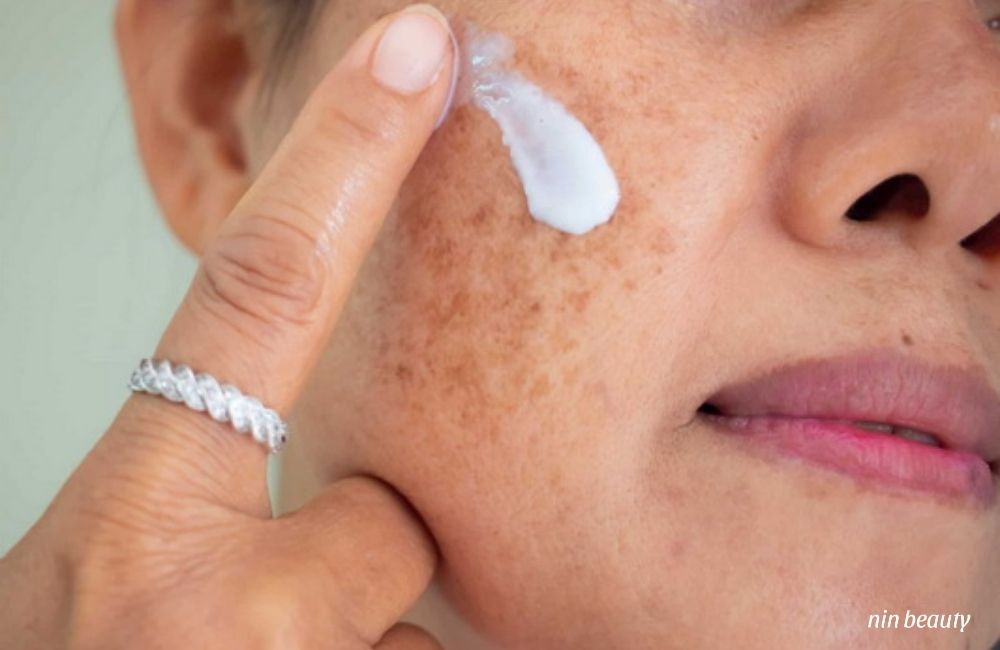 Những Sai Lầm Trong Bước Rửa Mặt Khiến Nám Nặng Hơn, Nguyên Nhân Ít Ai Ngờ Tới