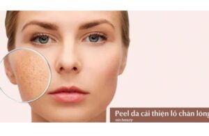 Càng Peel Lỗ Chân Lông Càng To? Liệu Bạn Đã Sai Ở Đâu?