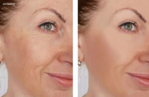 Sức Mạnh Trẻ Hóa Làn Da Từ Retinol Thiên Nhiên Bakuchiol 4 Sức Mạnh Trẻ Hóa Làn Da Từ Retinol Thiên Nhiên Bakuchiol