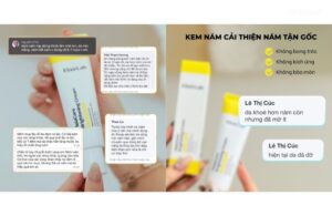 Hiểu Về Kem Nám ElixirLab – Giải Pháp Cho Làn Da Nám