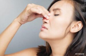 Nguyên Nhân Hay Mọc Mụn Viêm Ở Mũi Và Giải Pháp Ngay Tại Nhà