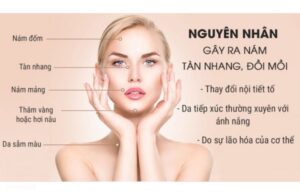 Sẽ Không Có Loại Kem Nám Nào Bôi Là Trị Được Sạch Nám