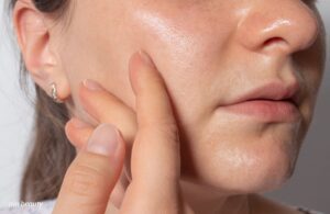 Da Nhiều Dầu Mụn Cần Rửa Mặt Mấy Lần Trong Một Ngày?