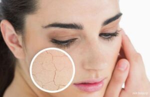 Các Dấu Hiệu Cho Thấy Làn Da Đang Không Hấp Thụ Dưỡng Chất
