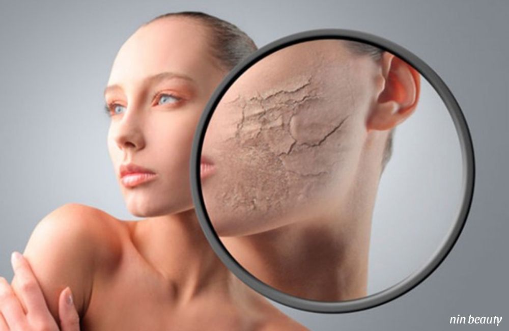 Các Triệu Chứng Cho Thấy Da Đang Mất Nước Và Cách Khắc Phục
