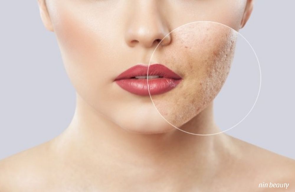 Các Dấu Hiệu Cho Thấy Làn Da Đang Không Hấp Thụ Dưỡng Chất