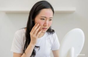 Vì Sao Không Nên Lạm Dụng Nhiều Hoạt Chất Mạnh Trong Chăm Sóc Da 2 Vì Sao Không Nên Lạm Dụng Nhiều Hoạt Chất Mạnh Trong Chăm Sóc Da