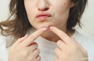 Dùng BHA Đẩy Mụn Cho Người Mới Bắt Đầu Cực Hiệu Quả